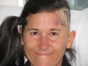 Day%20After%20surgery%202009[1]